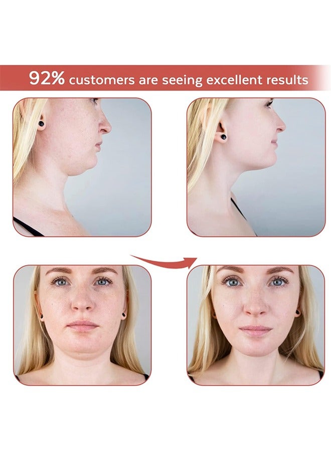 Reusable V Line Mask, Facial Slimming Strap Double Chin Reducer Chin Up Mask Face Lifting Belt V Shaped Slimming Face Mask, Tight and Lift Mask, Face Slimmer Shaper, Chin Face Slimming Belt - Image 2